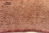 3 - Cellule corticali in visione superficiale